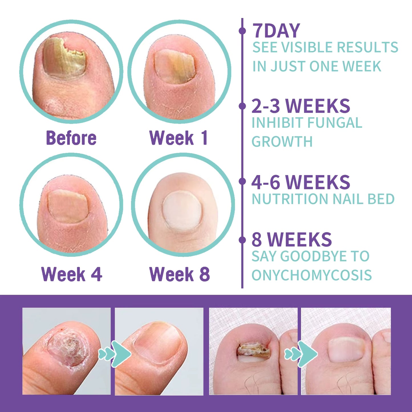 Nail healing & care Spray