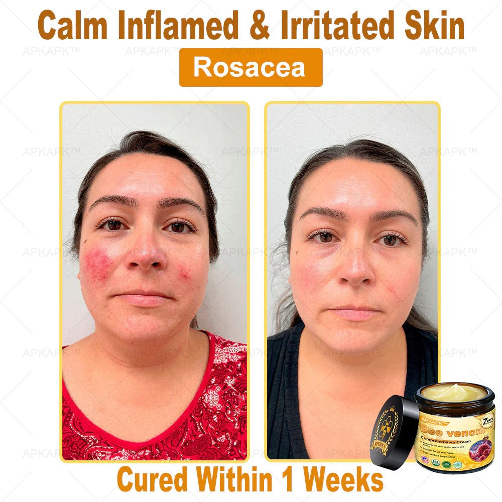 Professional Bee Venom Repair Cream, For All Body Parts