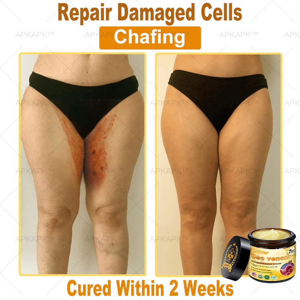 Professional Bee Venom Repair Cream, For All Body Parts
