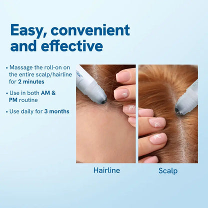 Hair Growth Roll - On Serum - See Results in 10 days!
