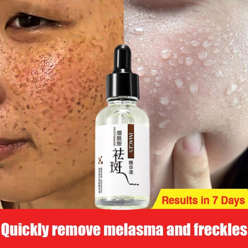 Hymey's Whitening & Anti Freckle Serum
