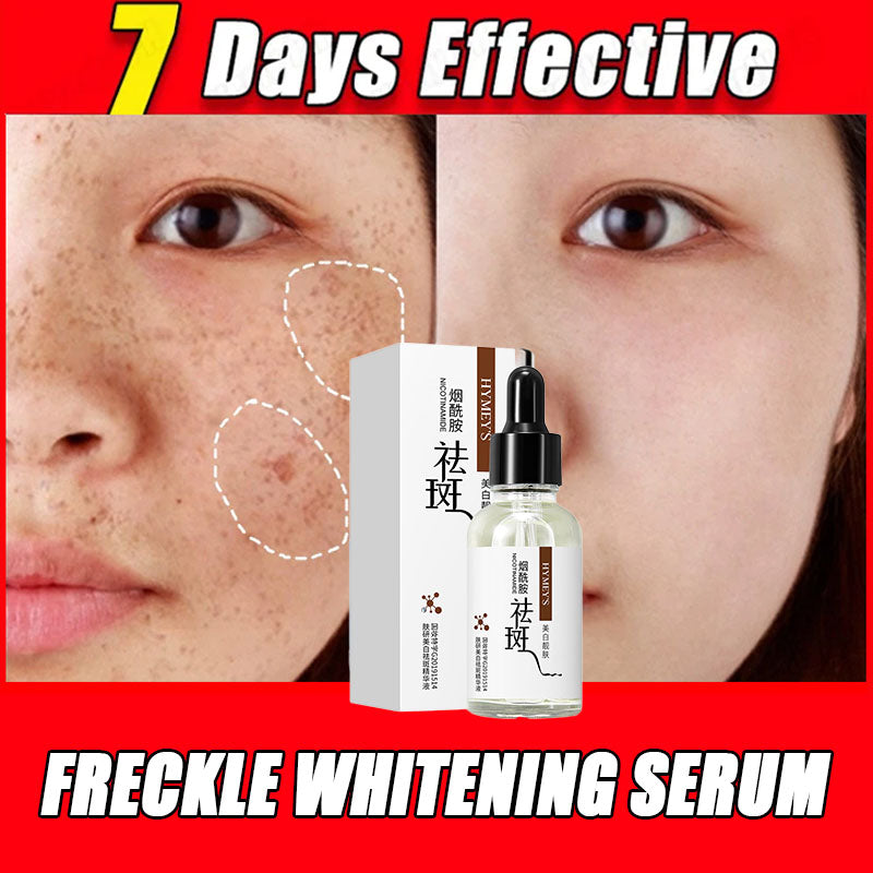 Hymey's Whitening & Anti Freckle Serum