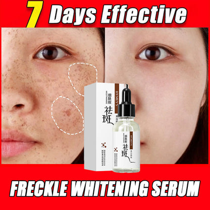 Hymey's Whitening & Anti Freckle Serum
