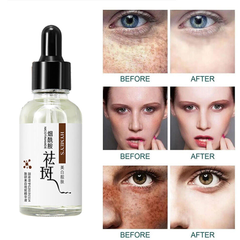 Hymey's Whitening & Anti Freckle Serum