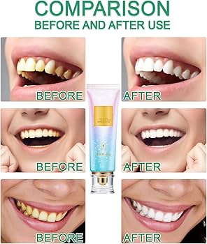 🦷 Niacinamide Whitening Toothpaste - For Healthier, Whiter Teeth!