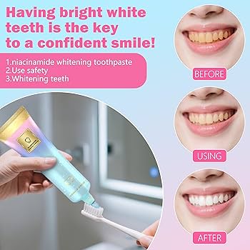 🦷 Niacinamide Whitening Toothpaste - For Healthier, Whiter Teeth!